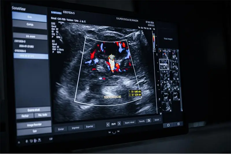 Curso de ultrassom