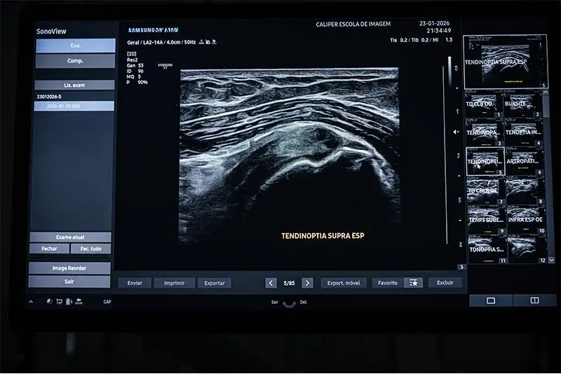 Curso de ultrassom músculo esquelético