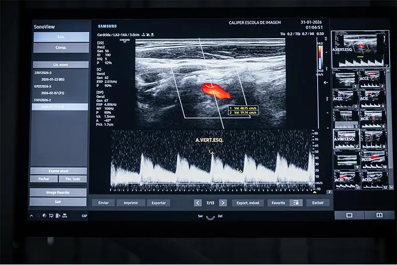 Curso em ultrassonografia com doppler